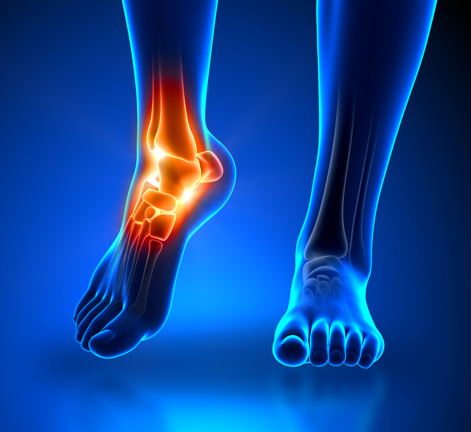 For How Long Have Your Shoes Been Causing Your Headaches?